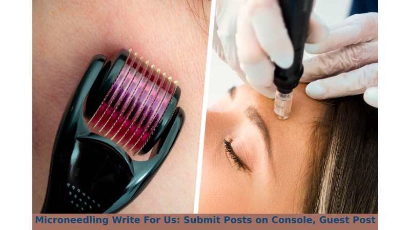 Microneedling Write For Us: Submit Posts on Console, Guest Post