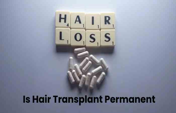 Hair Transplant Permanent